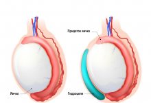 Photo of Опасность водянки у детей