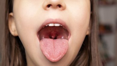 Photo of Чем опасен ангина у детей