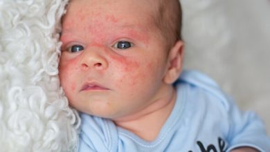 Photo of Детский дерматит: как избежать