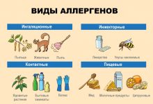 Photo of Детские аллергии: причины и симптомы
