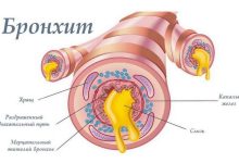 Photo of Острый бронхит у детей